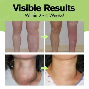 Cvreoz® Herbal Lymphatic Detox Cream