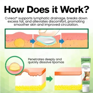 Cvreoz® Herbal Lymphatic Detox Cream