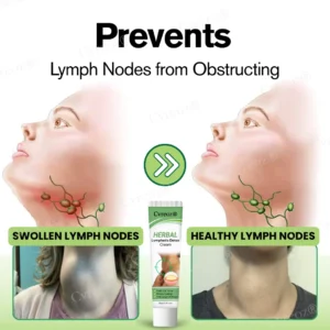 Cvreoz® Herbal Lymphatic Detox Cream