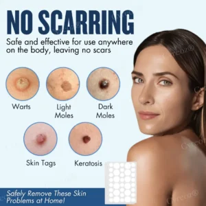 Cvreoz® Moles & Warts Removing Skin Tag Patch