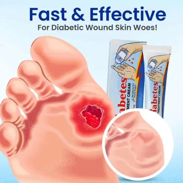 📢 Limited time offer Cvreoz® Diabetes Treatment Cream